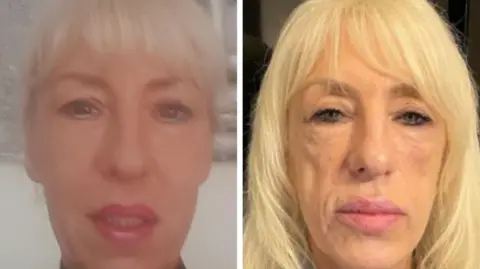 Handout A composite image of Andrea before and after her treatments. On the left she has white-blonde hair, striking blue eyes and red lipstick with eye liner and make-up on. On the right, he face looks gaunt and he cheeks are thin. She has lost volume in her lips. 