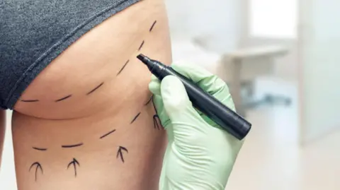 Getty Images A practitioner uses a marker pen to draw lines on a customer's right buttock