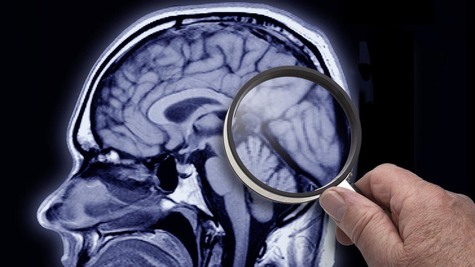 Researching the brain with a magnifying glass