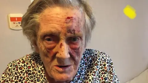 BBC Kylie Gobin's mother Winifred Tubb with a bruised face