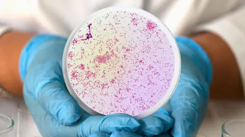 Getty Images A person wearing blue medical gloves holds a circular frame from a microscope containing Neisseria gonorrhoeae, the bacteria that causes gonorrhoea.