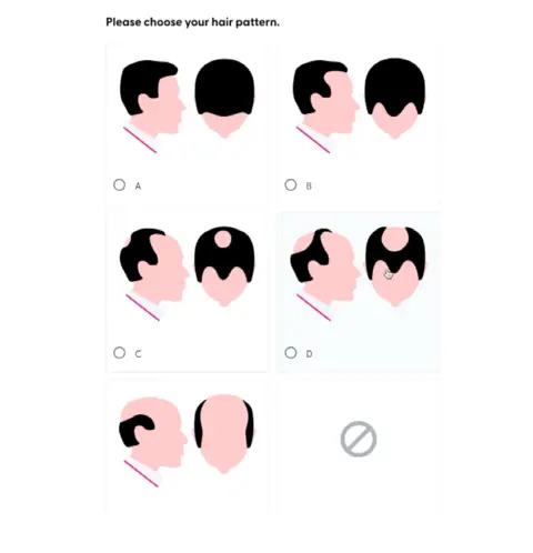 BBC News, courtesy of Superdrug Diagrams showing examples of male pattern hair loss that one of the online pharmacies asks customers to consider