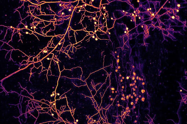  An image of a purple and yellow colored funghi network that resembles a network of tree roots.