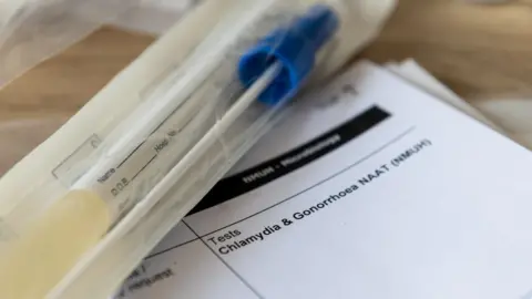 Getty Images Picture of a generic test for sexually transmitted infections