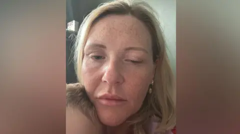 Nicola Fairley Close-up selfie image of Nicola Fairley, who has shoulder-length blond hair and freckles. Her left eye is almost fully closed.