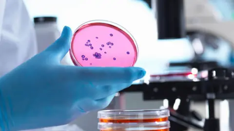 Getty Images Hand in a blue glove holding a petri dish with small purple growth of bacteria on it