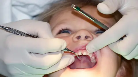 Getty Images Young child at dentist's with mouth wide open, close up dentist's hands using implements to examine the child's teeth.  