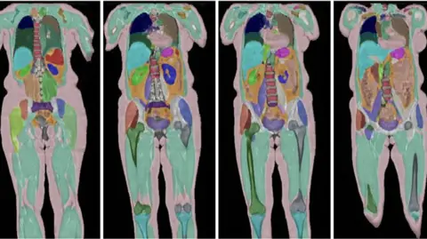 Bourigault et al. 2024 An image from the UK Biobank project. It shows for MRI scans of the body showing the legs and major organs including the heart, spine and stomach in different colours.