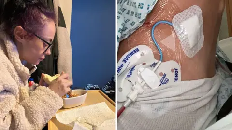 Maisie Two pictures of Maisie, the one on the left is showing her eating some food, very poorly and the one on the right is showing the tubes coming out of her kidneys