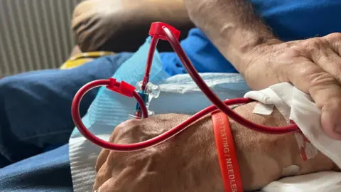 JOHN FAIRHALL/BBC Mr Henderson's left hand close up. You can see blood passing through tubes into his arm while he is undergoing dialysis. He has a red dialysis awareness wristband on his hand. He is putting pressure on his left hand on his right hand because it is bleeding, you can't see the blood from this.