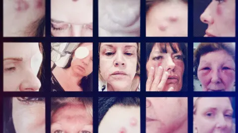 A montage of close-up photographs showing women with visible injuries and swelling around their eyes and faces, including bruising, drooping eyelids and red marks