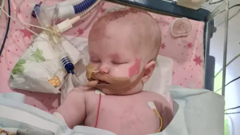 Corinne Wardle Baby Molly in a hospital cot with a tube taped to her mouth and monitors stuck to her chest. A sheet covers her lower body.