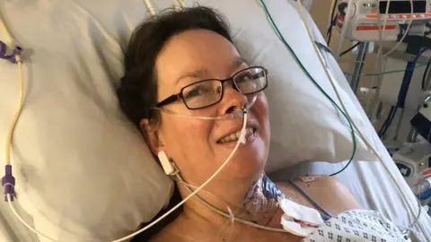 Head and shoulders of a woman lying in a hospital bed. She is wearing glasses, has a tube coming out of her nose and is wearing a hospital gown. She is smiling to the camera.