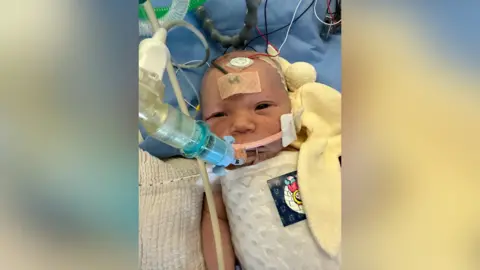 Family handout Mabel Williams is pictured lying in hospital with several wires around her and a blanket by her side. Her eyes are partially open. She has a tube feeding into her mouth.